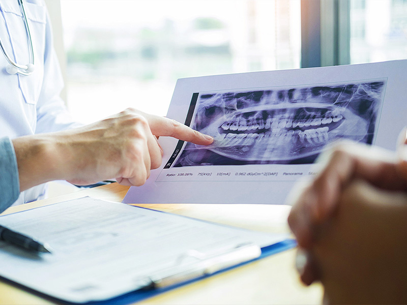 Planung des oralchirurgischen Eingriffes mit Röntgendiagnostik